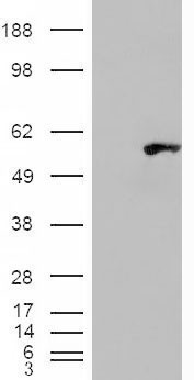 WIPF1 / WIP Antibody - HEK293 overexpressing WIPF1 (RC217601) and probed with (mock transfection in first lane).