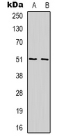 WIPF1 / WIP Antibody - Western blot analysis of WIPF1 expression in Jurkat (A); K562 (B) whole cell lysates.