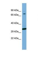 WIPF2 / WIRE Antibody - Western blot of Human Jurkat. WIPF2 antibody dilution 1.0 ug/ml.  This image was taken for the unconjugated form of this product. Other forms have not been tested.