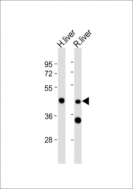 WIPF3 Antibody - All lanes: Anti-WIPF3 Antibody (N-term) at 1:2000 dilution. Lane 1: human liver lysate. Lane 2: rat liver lysate Lysates/proteins at 20 ug per lane. Secondary Goat Anti-Rabbit IgG, (H+L), Peroxidase conjugated at 1:10000 dilution. Predicted band size: 49 kDa. Blocking/Dilution buffer: 5% NFDM/TBST.