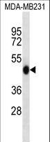 WIPI2 Antibody - WIPI2 Antibody western blot of MDA-MB231 cell line lysates (35 ug/lane). The WIPI2 antibody detected the WIPI2 protein (arrow).