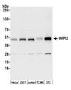 WIPI2 Antibody - Detection of human and mouse WIPI2 by western blot. Samples: Whole cell lysate (15 µg) from HeLa, HEK293T, Jurkat, mouse TCMK-1, and mouse NIH 3T3 cells prepared using NETN lysis buffer. Antibody: Affinity purified rabbit anti-WIPI2 antibody used for WB at 0.1 µg/ml. Detection: Chemiluminescence with an exposure time of 10 seconds.