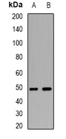 WIPI2 Antibody - Western blot analysis of WIPI2 expression in Jurkat (A); BT474 (B) whole cell lysates.