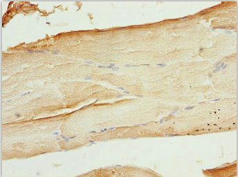 WIPI2 Antibody - Immunohistochemistry of paraffin-embedded human skeletal muscle tissue at dilution 1:100