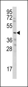 WISP3 Antibody - Western blot of anti-WISP3 Antibody in HepG2 cell line lysates (35 ug/lane). WISP3 (arrow) was detected using the purified antibody.