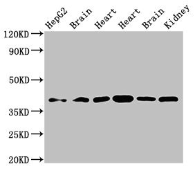 WISP3 Antibody - Western Blot Positive WB detected in:HepG2 whole cell lysate,Rat brain tissue,Rat heart tissue,Mouse heart tissue,Mouse brain tissue,Mouse kidney tissue All Lanes:WISP3 antibody at 3.5µg/ml Secondary Goat polyclonal to rabbit IgG at 1/50000 dilution Predicted band size: 40,42 KDa Observed band size: 40 KDa