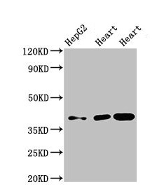 WISP3 Antibody - Western Blot Positive WB detected in: HepG2 whole cell lysate, Rat heart tissue, Mouse heart tissue All lanes: WISP3 antibody at 3.5µg/ml Secondary Goat polyclonal to rabbit IgG at 1/50000 dilution Predicted band size: 40, 42 kDa Observed band size: 40 kDa