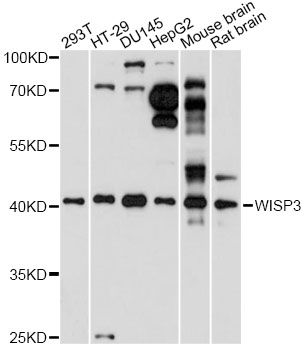 WISP3 Antibody - Western blot analysis of extracts of various cell lines, using WISP3 antibody at 1:1000 dilution. The secondary antibody used was an HRP Goat Anti-Rabbit IgG (H+L) at 1:10000 dilution. Lysates were loaded 25ug per lane and 3% nonfat dry milk in TBST was used for blocking. An ECL Kit was used for detection and the exposure time was 30s.