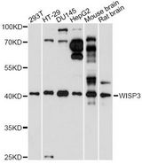 WISP3 Antibody - Western blot analysis of extracts of various cell lines, using WISP3 antibody at 1:1000 dilution. The secondary antibody used was an HRP Goat Anti-Rabbit IgG (H+L) at 1:10000 dilution. Lysates were loaded 25ug per lane and 3% nonfat dry milk in TBST was used for blocking. An ECL Kit was used for detection and the exposure time was 30s.