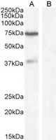 WIZ Antibody - WIZ antibody (1µg/ml) staining of Human Cerebellum lysate (A) + Blocking peptide (B) (35µg protein in RIPA buffer). Detected by chemiluminescence.