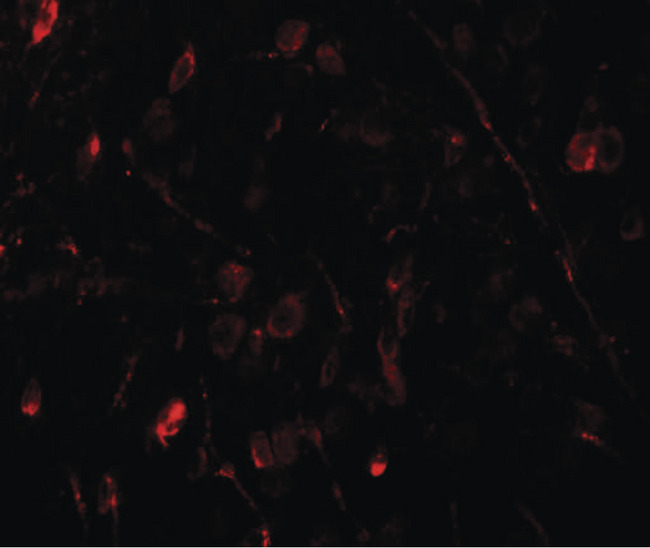 WIZ Antibody - Immunofluorescence of WIZ in human brain tissue with WIZ antibody at 20 ug/ml.