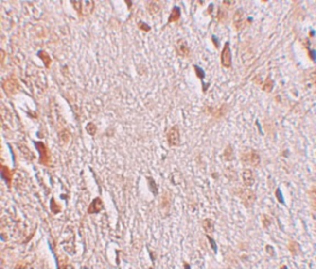 WIZ Antibody - Immunohistochemistry of WIZ in human brain tissue with WIZ antibody at 2.5 ug/ml.