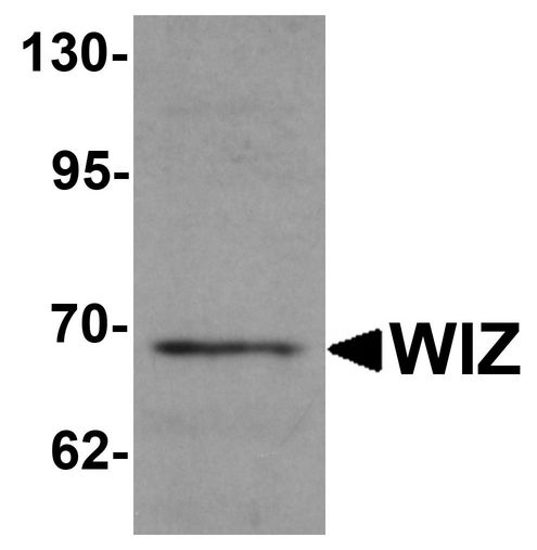 WIZ Antibody - Western blot analysis of WIZ in rat lung tissue lysate with WIZ antibody at 1 ug/ml.