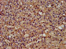 WLS / GPR177 Antibody - Immunohistochemistry image at a dilution of 1:200 and staining in paraffin-embedded human adrenal gland tissue performed on a Leica BondTM system. After dewaxing and hydration, antigen retrieval was mediated by high pressure in a citrate buffer (pH 6.0) . Section was blocked with 10% normal goat serum 30min at RT. Then primary antibody (1% BSA) was incubated at 4 °C overnight. The primary is detected by a biotinylated secondary antibody and visualized using an HRP conjugated SP system.