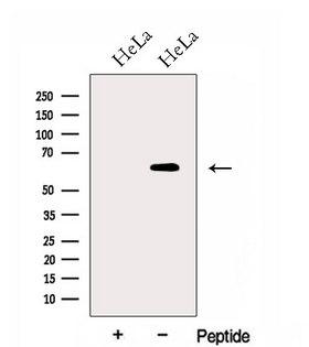 WLS / GPR177 Antibody - Western blot analysis of extracts of HeLa cells using GPR177 antibody. The lane on the left was treated with blocking peptide.