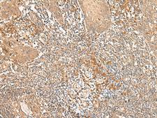 WLS / GPR177 Antibody - Immunohistochemistry of paraffin-embedded Human tonsil tissue  using WLS Polyclonal Antibody at dilution of 1:50(×200)