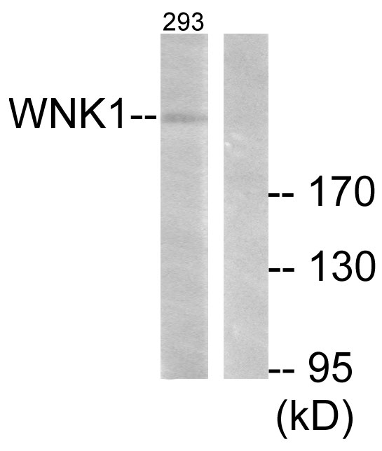 WNK1 Antibody - Western blot analysis of lysates from 293 cells, treated with EGF 200ng/ml 30', using WNK1 Antibody. The lane on the right is blocked with the synthesized peptide.