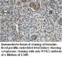 WNK1 Antibody