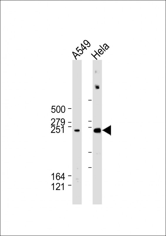 WNK1 Antibody - All lanes: Anti-WNK1 Antibody (C-Term) at 1:2000 dilution Lane 1: A549 whole cell lysate Lane 2: Hela whole cell lysate Lysates/proteins at 20 µg per lane. Secondary Goat Anti-Rabbit IgG, (H+L), Peroxidase conjugated at 1/10000 dilution. Predicted band size: 251 kDa Blocking/Dilution buffer: 5% NFDM/TBST.