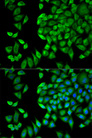 WNK1 Antibody - Immunofluorescence analysis of HeLa cells.