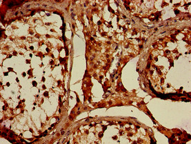 WNK1 Antibody - Immunohistochemistry of paraffin-embedded human testis tissue using WNK1 Antibody at dilution of 1:100