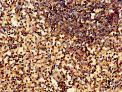 WNK1 Antibody - Immunohistochemistry of paraffin-embedded human spleen tissue using WNK1 Antibody at dilution of 1:100