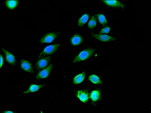 WNK1 Antibody - Immunofluorescent analysis of A549 cells using WNK1 Antibody at a dilution of 1:100 and Alexa Fluor 488-congugated AffiniPure Goat Anti-Rabbit IgG(H+L)