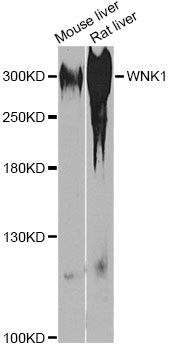 WNK1 Antibody - Western blot analysis of extracts of various cell lines, using WNK1 antibody at 1:1000 dilution. The secondary antibody used was an HRP Goat Anti-Rabbit IgG (H+L) at 1:10000 dilution. Lysates were loaded 25ug per lane and 3% nonfat dry milk in TBST was used for blocking. An ECL Kit was used for detection and the exposure time was 90s.