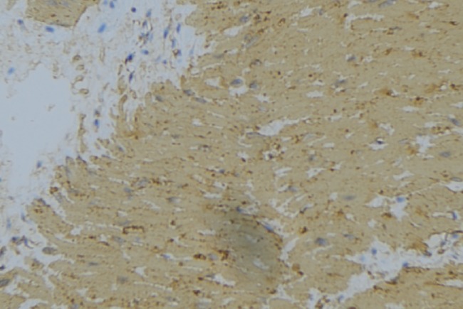 WNK1 Antibody - 1:100 staining mouse muscle tissue by IHC-P. The sample was formaldehyde fixed and a heat mediated antigen retrieval step in citrate buffer was performed. The sample was then blocked and incubated with the antibody for 1.5 hours at 22°C. An HRP conjugated goat anti-rabbit antibody was used as the secondary.