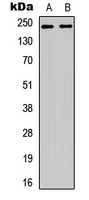 WNK1 Antibody - Western blot analysis of p65 (pT60) expression in HEK293T EGF-treated (A); Jurkat EGF-treated (B) whole cell lysates.