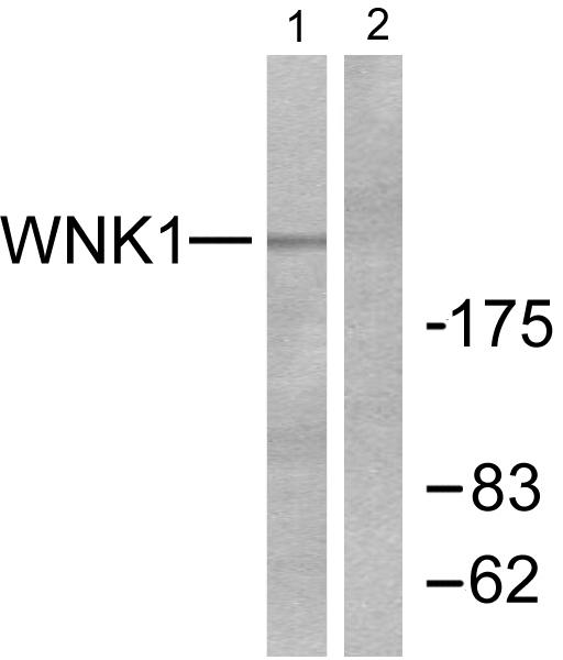 WNK1 Antibody - Western blot analysis of extracts from 293 cells treated with EGF (200ng/ml, 30mins), using WNK1 (Ab-58) antibody.
