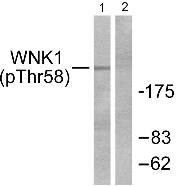 WNK1 Antibody - Western blot analysis of extracts from 293 cells treated with EGF (200ng/ml, 30mins), using WNK1 (Phospho-Thr58) antibody.