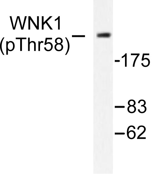 WNK1 Antibody - Western blot of p-WNK1 (T60) pAb in extracts from 293 cells treated with EGF.