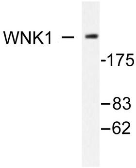 WNK1 Antibody - Western blot of WNK1 (Y52) pAb in extracts from 293 cells treated with EGF 200ng/ml 30'.