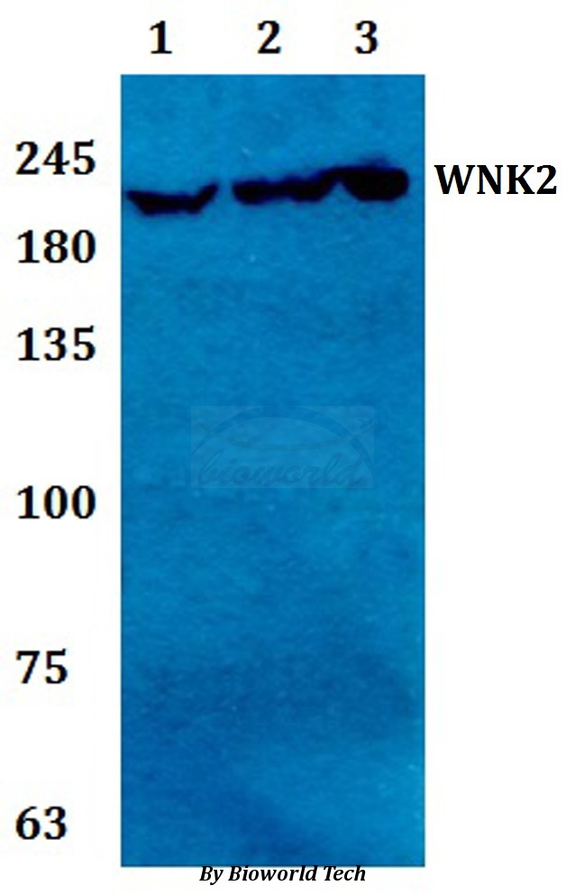 WNK2 Antibody - Western blot of WNK2 antibody at 1:500 Line1:HeLa whole cell lysate Line2:H9C2 whole cell lysate Line3:Raw264.7 whole cell lysate.