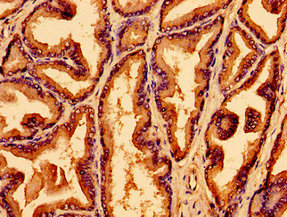 WNK2 Antibody - Immunohistochemistry image of paraffin-embedded human prostate tissue at a dilution of 1:100