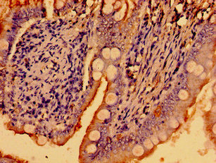 WNK2 Antibody - Immunohistochemistry image of paraffin-embedded human small intestine tissue at a dilution of 1:100