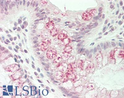 WNK3 / PRKWNK3 Antibody - Human Colon: Formalin-Fixed, Paraffin-Embedded (FFPE).  This image was taken for the unconjugated form of this product. Other forms have not been tested.