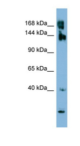 WNK3 / PRKWNK3 Antibody - Anti-WNK3 antibody western blot of ACHN cell lysate.  This image was taken for the unconjugated form of this product. Other forms have not been tested.