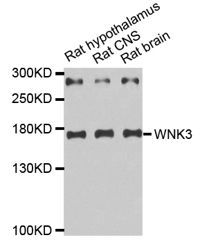 WNK3 / PRKWNK3 Antibody - Western blot analysis of extracts of various tissues.