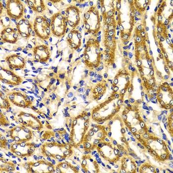 WNK3 / PRKWNK3 Antibody - Immunohistochemistry of paraffin-embedded Rat kidney tissue.