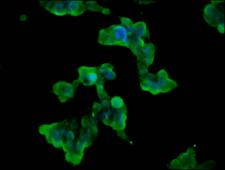 WNK3 / PRKWNK3 Antibody - Immunofluorescence staining of 293 cells diluted at 1:100, counter-stained with DAPI. The cells were fixed in 4% formaldehyde, permeabilized using 0.2% Triton X-100 and blocked in 10% normal Goat Serum. The cells were then incubated with the antibody overnight at 4°C.The Secondary antibody was Alexa Fluor 488-congugated AffiniPure Goat Anti-Rabbit IgG (H+L).