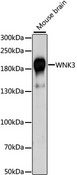 WNK3 / PRKWNK3 Antibody - Western blot analysis of extracts of mouse brain, using WNK3 antibody at 1:1000 dilution. The secondary antibody used was an HRP Goat Anti-Rabbit IgG (H+L) at 1:10000 dilution. Lysates were loaded 25ug per lane and 3% nonfat dry milk in TBST was used for blocking. An ECL Kit was used for detection and the exposure time was 60s.
