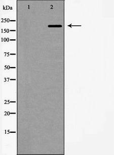 WNK3 / PRKWNK3 Antibody - Western blot analysis of mouse brain lysate using WNK3 antibody. The lane on the left is treated with the antigen-specific peptide.