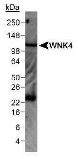 WNK4 Antibody - Detection of WNK4 in mouse kidney lysate.  This image was taken for the unconjugated form of this product. Other forms have not been tested.