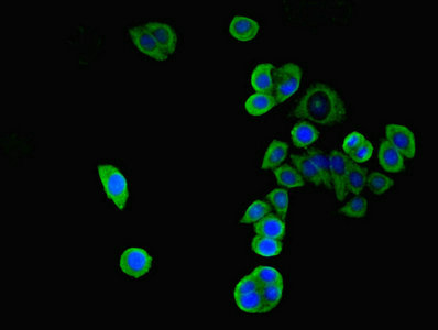 WNK4 Antibody - Immunofluorescent analysis of PC3 cells cells diluted at 1:100 and Alexa Fluor 488-congugated AffiniPure Goat Anti-Rabbit IgG(H+L)