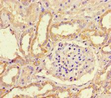WNK4 Antibody - Immunohistochemistry of paraffin-embedded human kidney tissue at dilution of 1:100