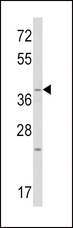 WNT1 Antibody - Western blot of WNT1 Antibody in mouse heart tissue lysates (35 ug/lane). WNT1 (arrow) was detected using the purified antibody.