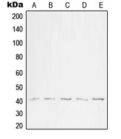 WNT1 Antibody - Western blot analysis of WNT1 expression in HEK293T (A); SP2/0 (B); H9C2 (C); WI38 (D); NIH3T3 (E) whole cell lysates.