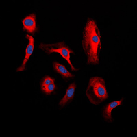 WNT1 Antibody - Immunofluorescent analysis of WNT1 staining in H9C2 cells. Formalin-fixed cells were permeabilized with 0.1% Triton X-100 in TBS for 5-10 minutes and blocked with 3% BSA-PBS for 30 minutes at room temperature. Cells were probed with the primary antibody in 3% BSA-PBS and incubated overnight at 4 C in a humidified chamber. Cells were washed with PBST and incubated with a DyLight 594-conjugated secondary antibody (red) in PBS at room temperature in the dark. DAPI was used to stain the cell nuclei (blue).